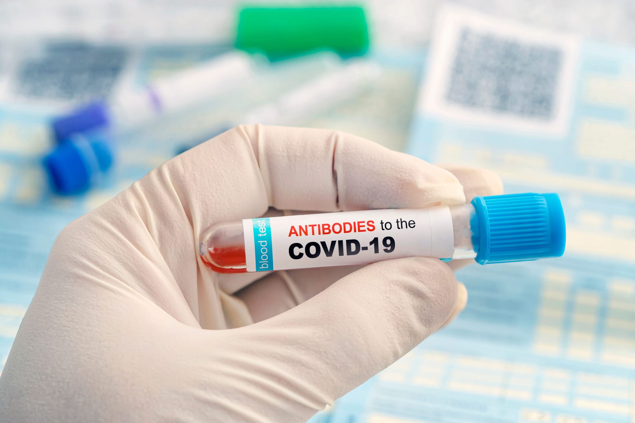 Conheça as diferenças entre os testes diagnósticos para Covid-19